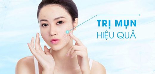Bất ngờ với cách trị mụn tuổi dậy thì siêu đơn giản như hiệu quả cực cao