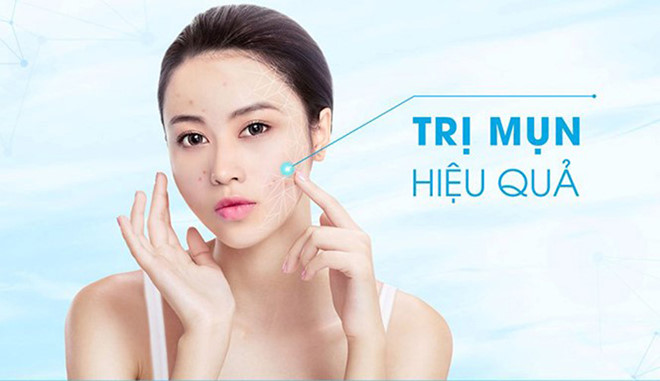 Bất ngờ với cách trị mụn tuổi dậy thì siêu đơn giản như hiệu quả cực cao