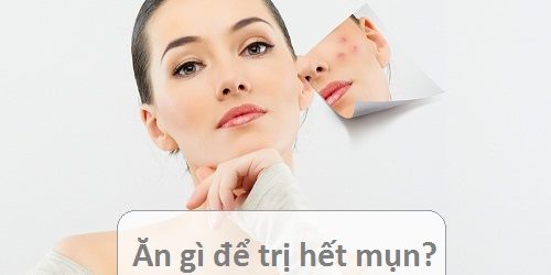 Chế độ ăn cho da bị mụn: Nên và không nên ăn gì để mụn “lặn mất tăm”