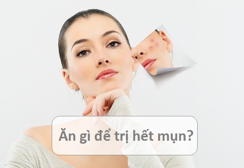 Chế độ ăn cho da bị mụn: Nên và không nên ăn gì để mụn “lặn mất tăm”